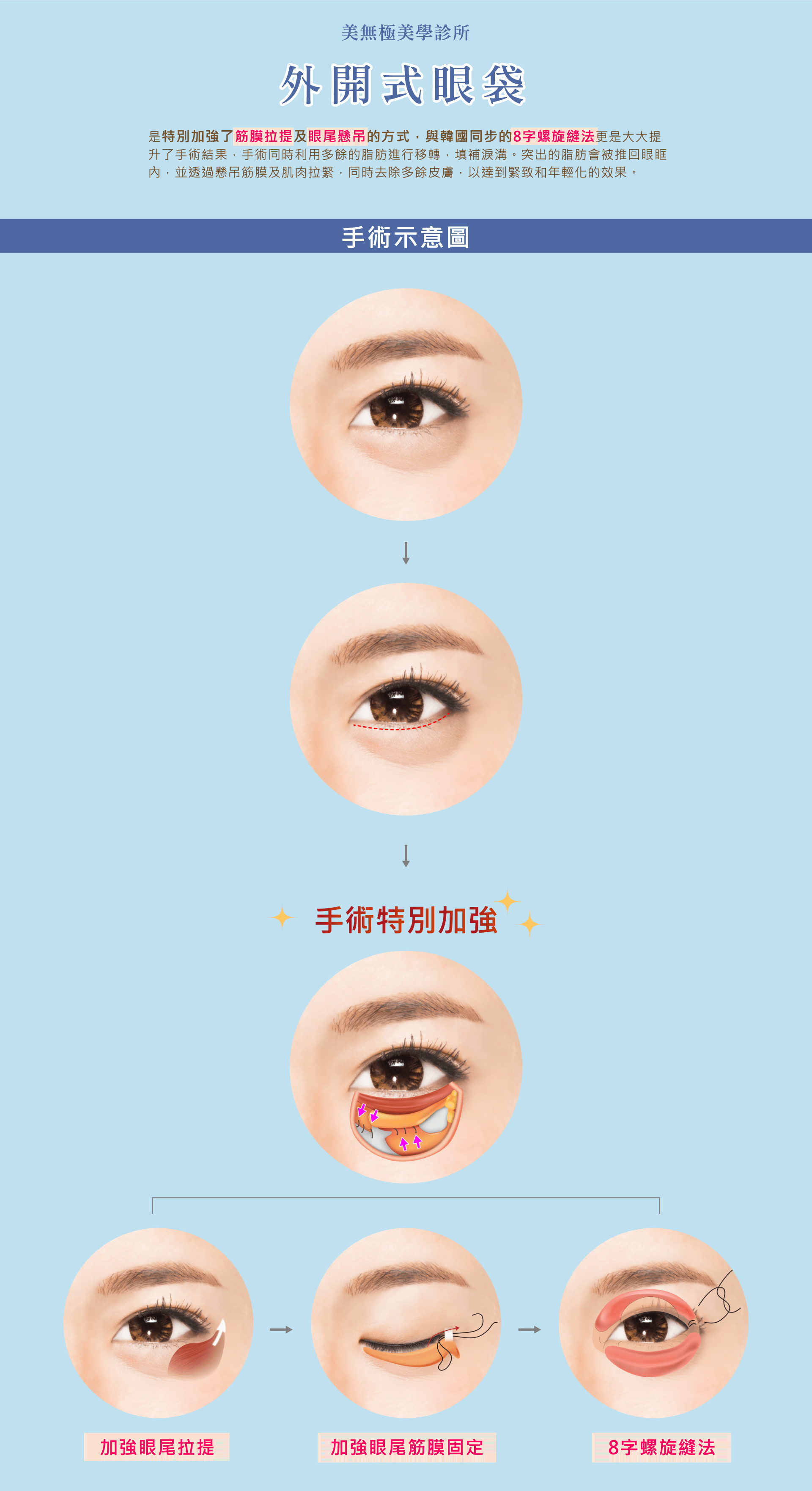 eye_03web